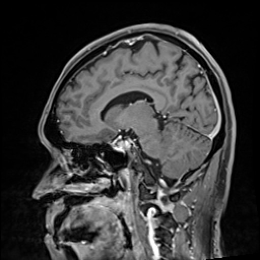 Click on the Serie image to view the images of VILLANUEVA, WILLIAM A.